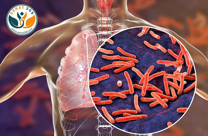 Under the National Tuberculosis Elimination Program (NTEP), there has been a remarkable expansion of diagnostic and treatment facilities in the past few years.